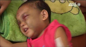 Clip: Bé 4 tuổi bị cha mẹ hành hạ dã man ở Bình Dương