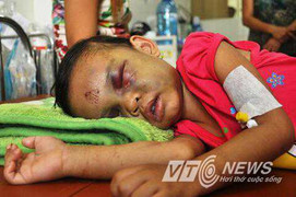 Khởi tố 2 kẻ hành hạ bé gái 4 tuổi như thời trung cổ