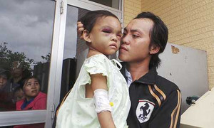 Bé 4 tuổi bị bạo hành: Ai được quyền nuôi dưỡng bé Ngân?