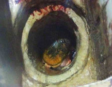 Tắc nghẹt trong ống thải, bé sơ sinh khóc thất thanh