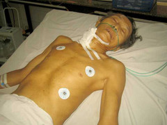 Cha bị con có dấu hiệu tâm thần cứa cổ khi đang ngủ