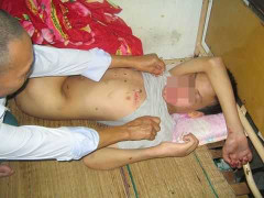 Bắt cóc cháu trai 14 tuổi, đốt tóc và cắn bầm 2 tai