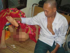 Cháu trai tàn tật bị xâm hại: Có thể bị xối nước sôi