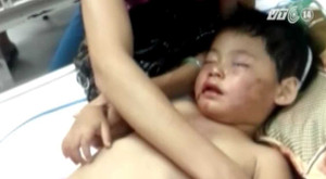 Bé 2 tuổi bị đánh gãy răng, nhét băng vệ sinh vào mồm