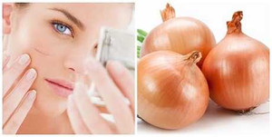 7 'bí kíp' cực đơn giản trị sẹo lồi sau mổ