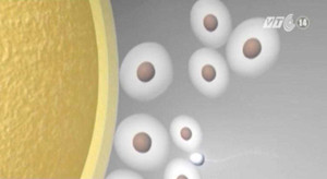 Em bé chào đời từ tinh trùng dị dạng ở Việt Nam