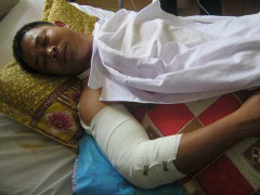 Tài xế kể giây phút loa phát nổ, đối mặt xe container