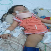 Xót xa bé 15 tháng tuổi bị đánh chấn thương sọ não