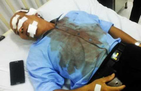 'Sếp' đường bộ bị giám đốc công ty cầu đường đánh trọng thương