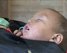 Dịch bệnh tấn công miền tây xứ Nghệ, đã có trẻ tử vong