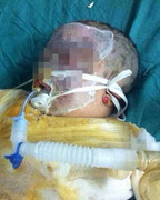 Dùng xăng tẩy vết bẩn, hai vợ chồng và con bị bốc cháy