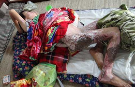 Nghi án cháu trai 13 tuổi bị mẹ xô vào đống lửa