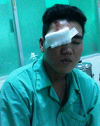 Bệnh viện mắt từ chối cấp cứu: Bộ Y tế chỉ đạo làm rõ