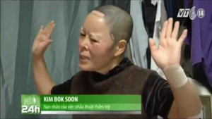 Thành 'quái vật' sau phẫu thuật thẩm mỹ ở Hàn Quốc