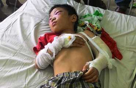 Bé 6 tuổi bị cha dượng đánh: Chấn thương như vụ tai nạn giao thông