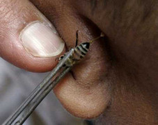 Chỉ vì chơi dại, hậu quả khôn lường