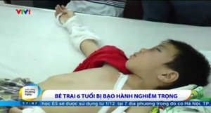 Video: Bé 6 tuổi bị cha dượng đánh rạn hộp sọ