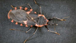 Hơn 300.000 người Mỹ nghi mắc phải bệnh 'AIDS mới'