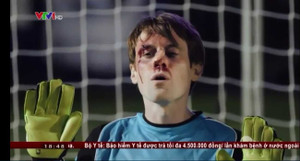 Clip thủ môn xui xẻo 5 lần bị bóng đập vào mặt chảy máu