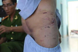 Hai chú tiểu bị hành hạ, đánh đập dã man