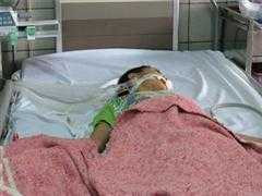 Em tử vong, anh nguy kịch sau khi ăn ốc biển