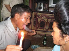 Những kiểu chữa bệnh kỳ quái, không thể tin nổi ở Sơn La