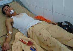 Trộm xe đâm trọng thương CSGT