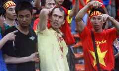 CĐV Việt Nam bị fan cuồng Malaysia đánh chảy máu mặt