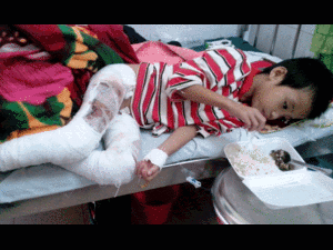 Đau lòng bố châm lửa dọa, không ngờ thiêu chân con