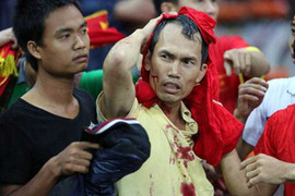 VFF hứa đảm bảo an toàn cho fan Malaysia