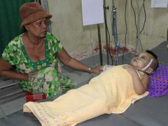 Bé 2 tuổi bị bà ngoại đánh đến lơ mơ, phù nề