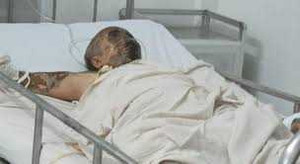 Đang ăn sáng, đại gia bị tạt axit