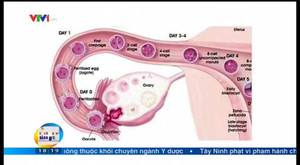 Vô sinh gia tăng do đâu?