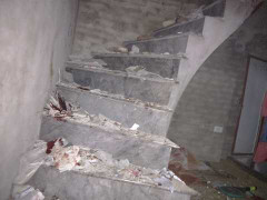 Thuốc pháo nổ lớn như bom, nam thanh niên nguy kịch