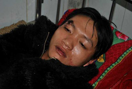 Hai thanh niên nghi là cẩu tặc giả chết để sống sót