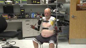 Người đầu tiên trên thế giới lắp cánh tay robot