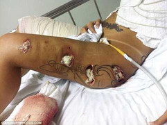 Chân dài miên man của Á hậu bị mục nát khủng khiếp