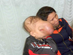 Hành trình đi tìm khuôn mặt của cậu bé 'không có mặt'