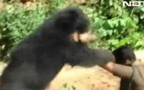 Kinh hoàng những vụ gấu tấn công người trong vườn nhà 'đại gia'