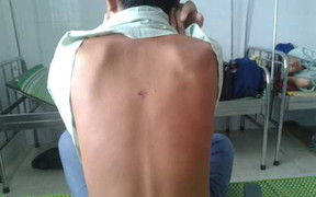 Trưởng công an xã vô cớ bắt, nhốt, đánh đập dân bị đình chỉ