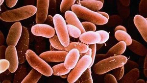 Vi khuẩn trong táo caramel ảnh hưởng sức khỏe thế nào?