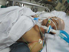 Vô cớ đánh người vỡ sọ vẫn cố đổ lỗi