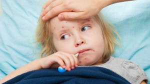 Bệnh sởi: Dấu hiệu nhận biết và cách phòng ngừa