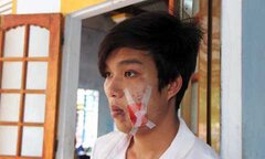 Dân: 'Bị Công an xã bắn', Công an xã: 'Lạc đạn'