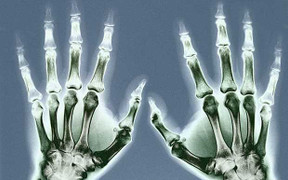 Ngón đeo nhẫn hé lộ đàn ông lăng nhăng