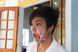 Sẽ điều tra vụ công an xã bắn 'lạc đạn' vào dân