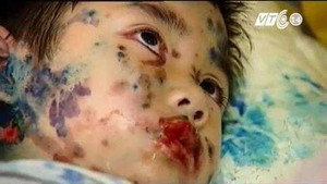 Rợn người xem mỹ phẩm tàn phá cơ thể