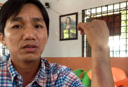 Ẩu đả sau va chạm xe, con trai giám đốc Công an Cà Mau lên tiếng