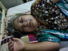 Cụ bà bị côn đồ đánh bầm dập: Đã xác định được kẻ chủ mưu