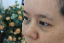 Tuyệt chiêu đánh bay quầng thâm mắt